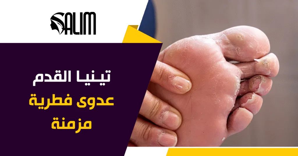 Athlete s Foot athlete-s-foot